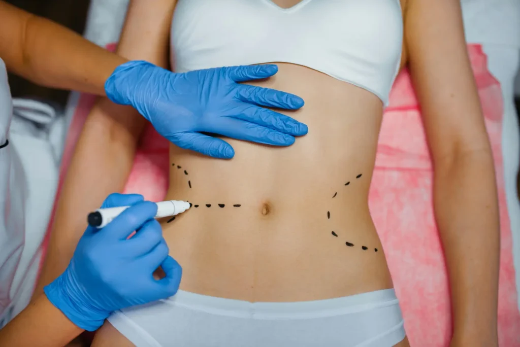Cosmetician applies markers to female patient body
